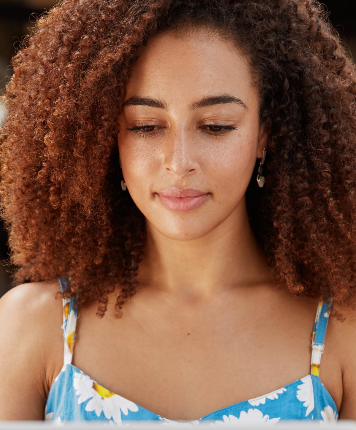 Palo Alto & San Jose Deep Chemical Peels model with brown hair