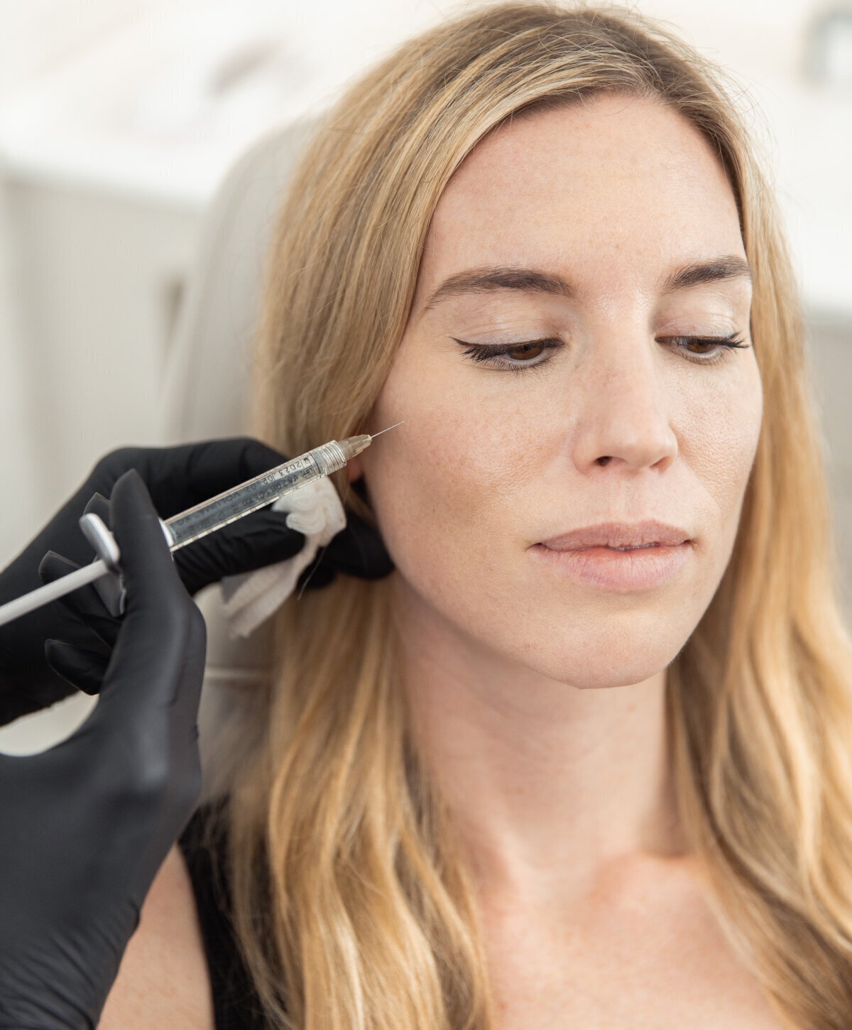 Are Dermal Fillers a Good Alternative to Facelifts?